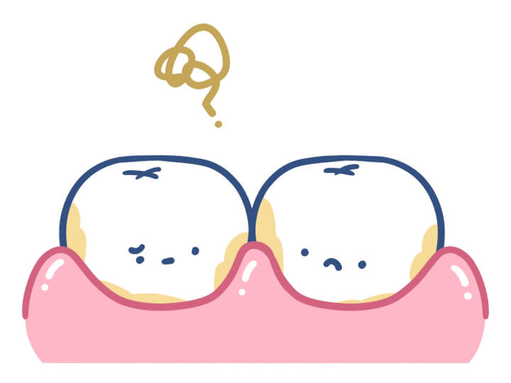 歯垢・歯石