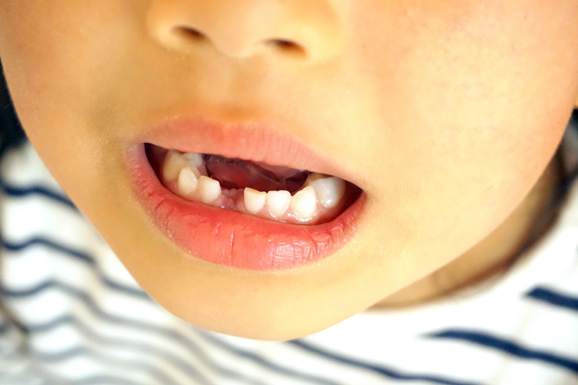 赤ちゃんの乳歯はどこから最初に生えてくる 時期や順番について 歯科オンライン