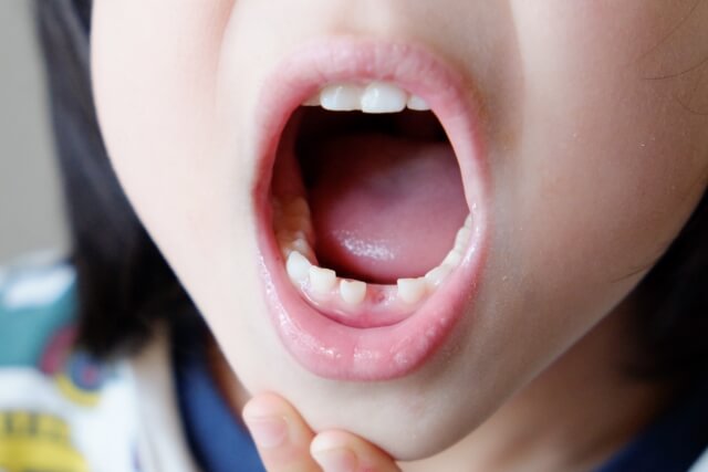 歯を見せる子ども