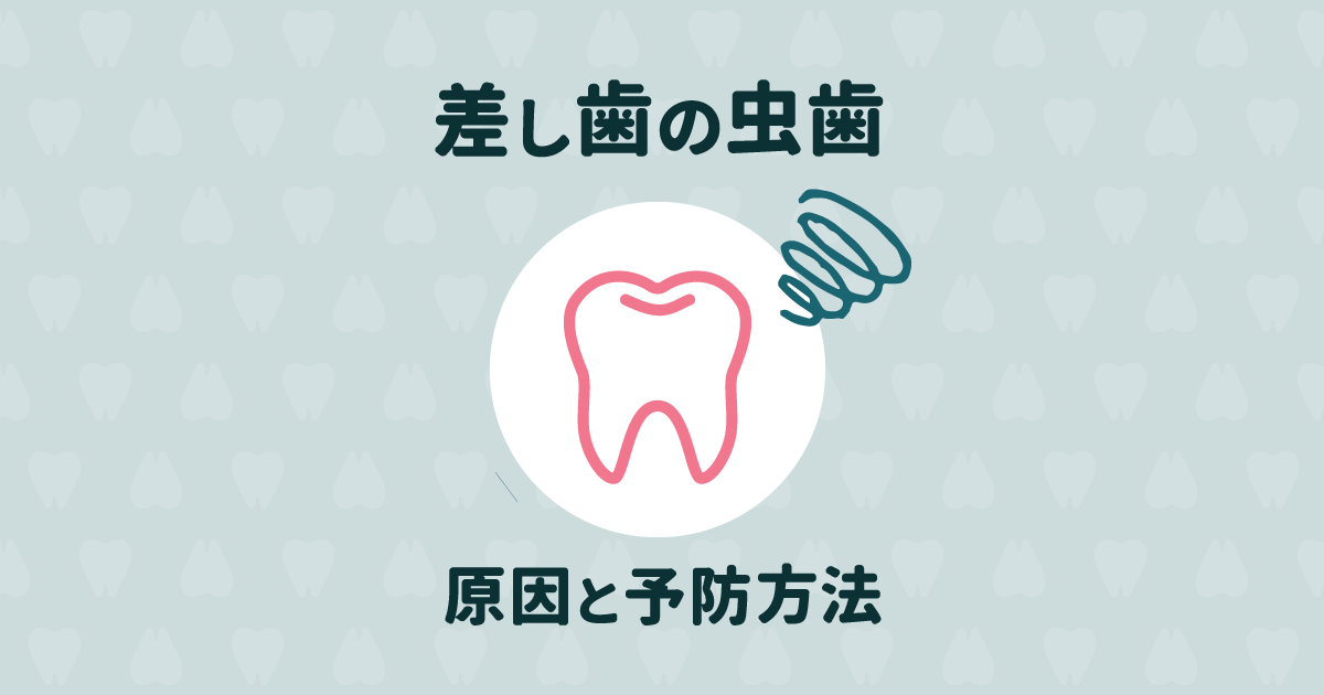 差し歯の下にご用心!差し歯が虫歯になる理由と予防法