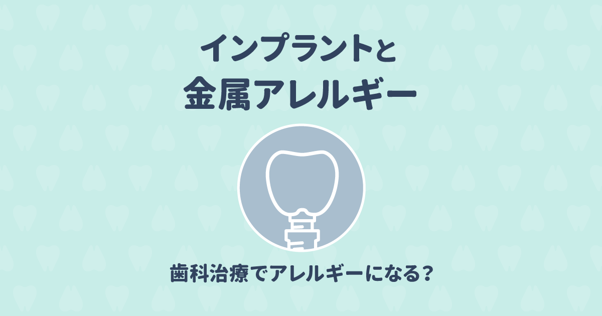 【歯科医監修】インプラントと金属アレルギーの関係を詳しく説明!
