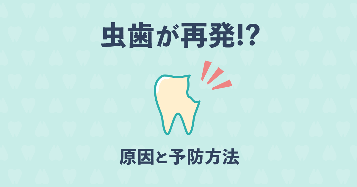 【歯科医監修】虫歯が再発してしまう原因と虫歯を防ぐ8つの方法