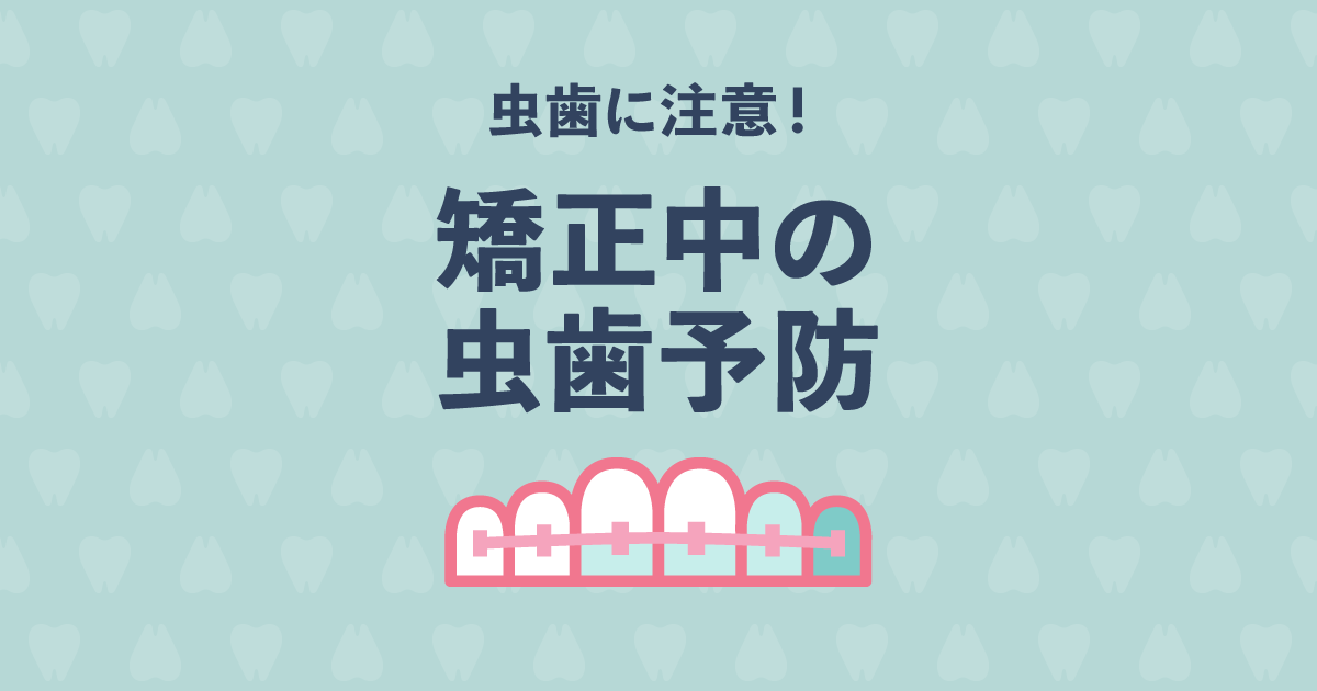 矯正中は虫歯になりやすい! どうする?矯正中の虫歯予防