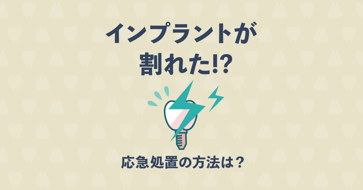 インプラントが割れた!応急処置の方法は?どの病院に行けばいいの?