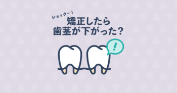 歯列矯正をしたら歯茎が下がった？歯茎が下がる歯肉退縮の原因と改善法