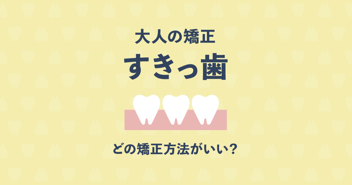 大人のすきっ歯の矯正はどの方法がベスト？ 5つの矯正方法と選び方