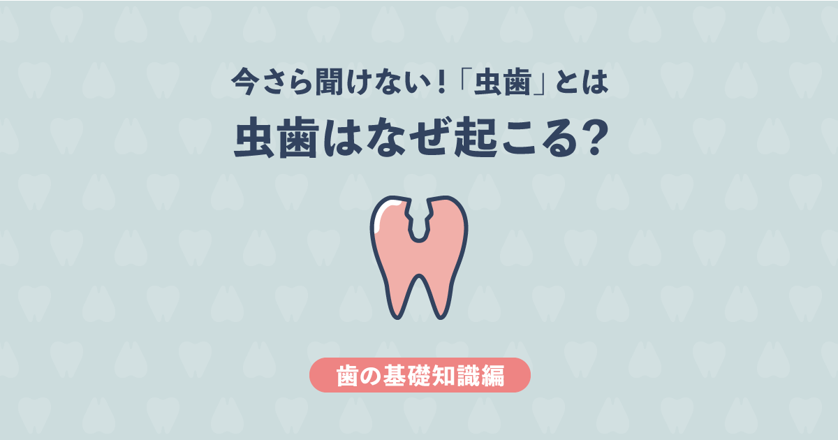 【基礎知識編】今さら聞けない虫歯とは?虫歯はなぜ起こるの?