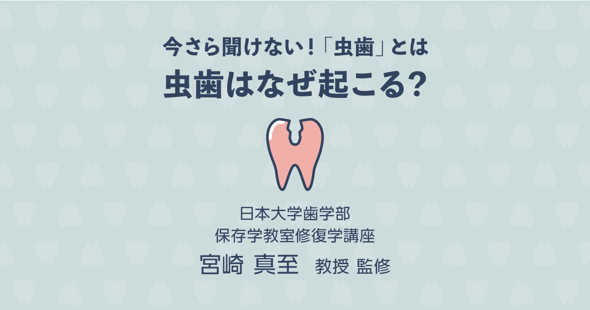 【基礎知識編】今さら聞けない虫歯とは？虫歯はなぜ起こるの？