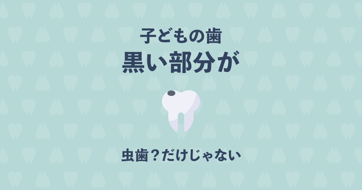 子どもの歯が黒いと感じたら 虫歯じゃなくても黒くなる4つの理由 歯科オンライン