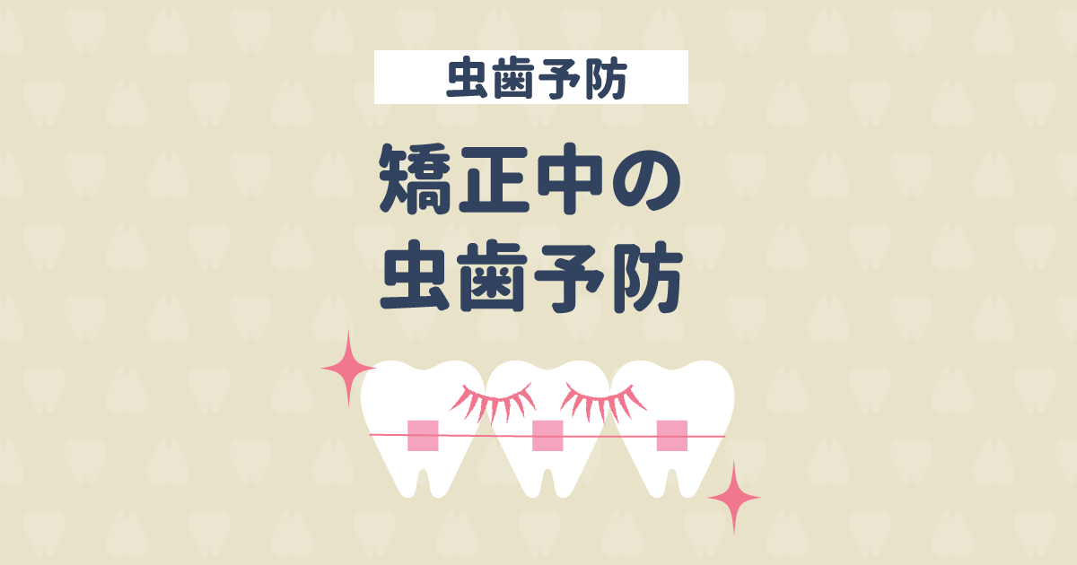 矯正中は虫歯になりやすい! どうする?矯正中の虫歯予防