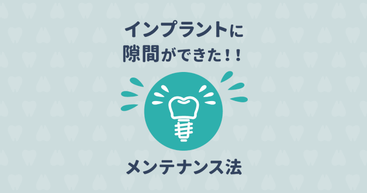 インプラントにできたこの隙間って何?正しい知識とメンテナンス法