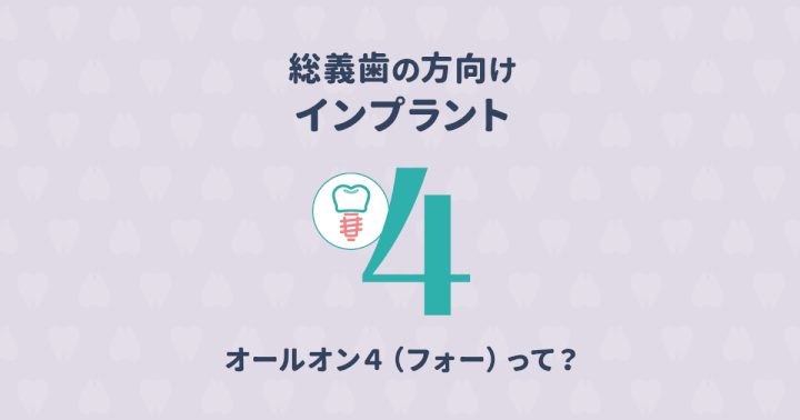 治療期間も費用も節約できるインプラント「オールオン4」とは?
