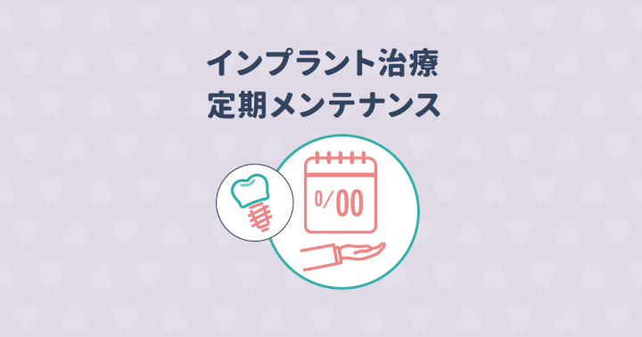 インプラントの定期メンテナンスの様々な疑問にお答えします!