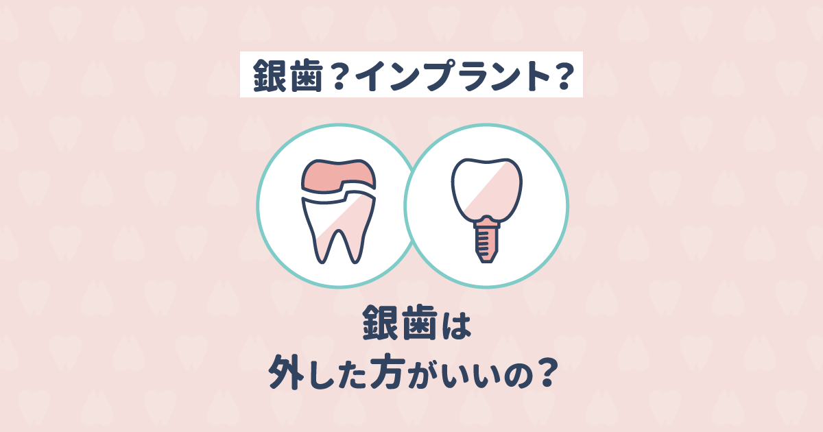 銀歯とインプラント、どちらがおすすめ?銀歯は取った方がいい?