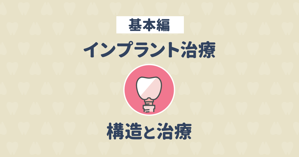 インプラントの構造や治療内容、用語について分かりやすく説明します