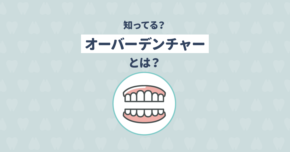 インプラントと併用する「オーバーデンチャー」とは?その構造や種類