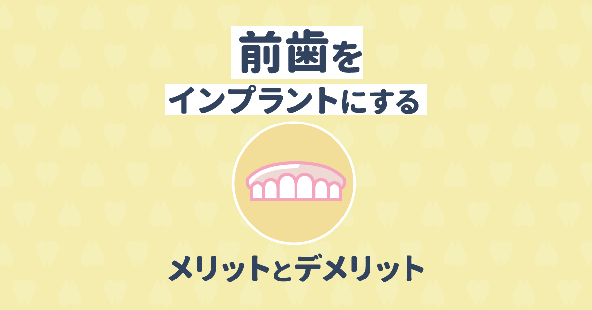 【歯科医監修】前歯をインプラントにするメリットとデメリット