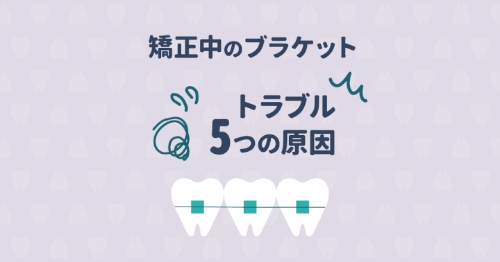 歯列矯正中のブラケットは取れやすい?ブラケットのトラブル5つの原因