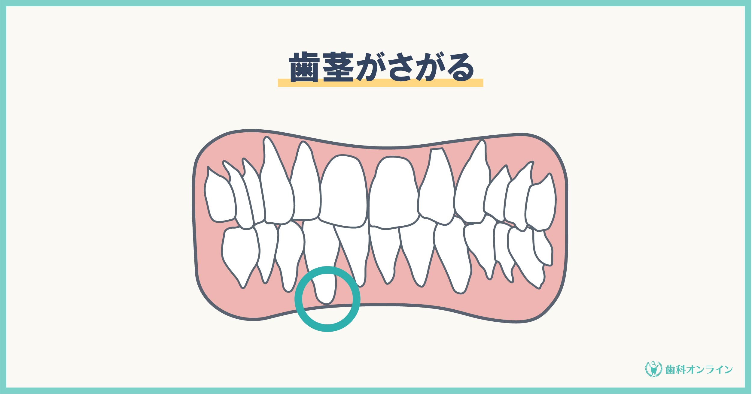 矯正でほうれい線が出現 大人の矯正で起こるトラブルやリスク 歯科オンライン