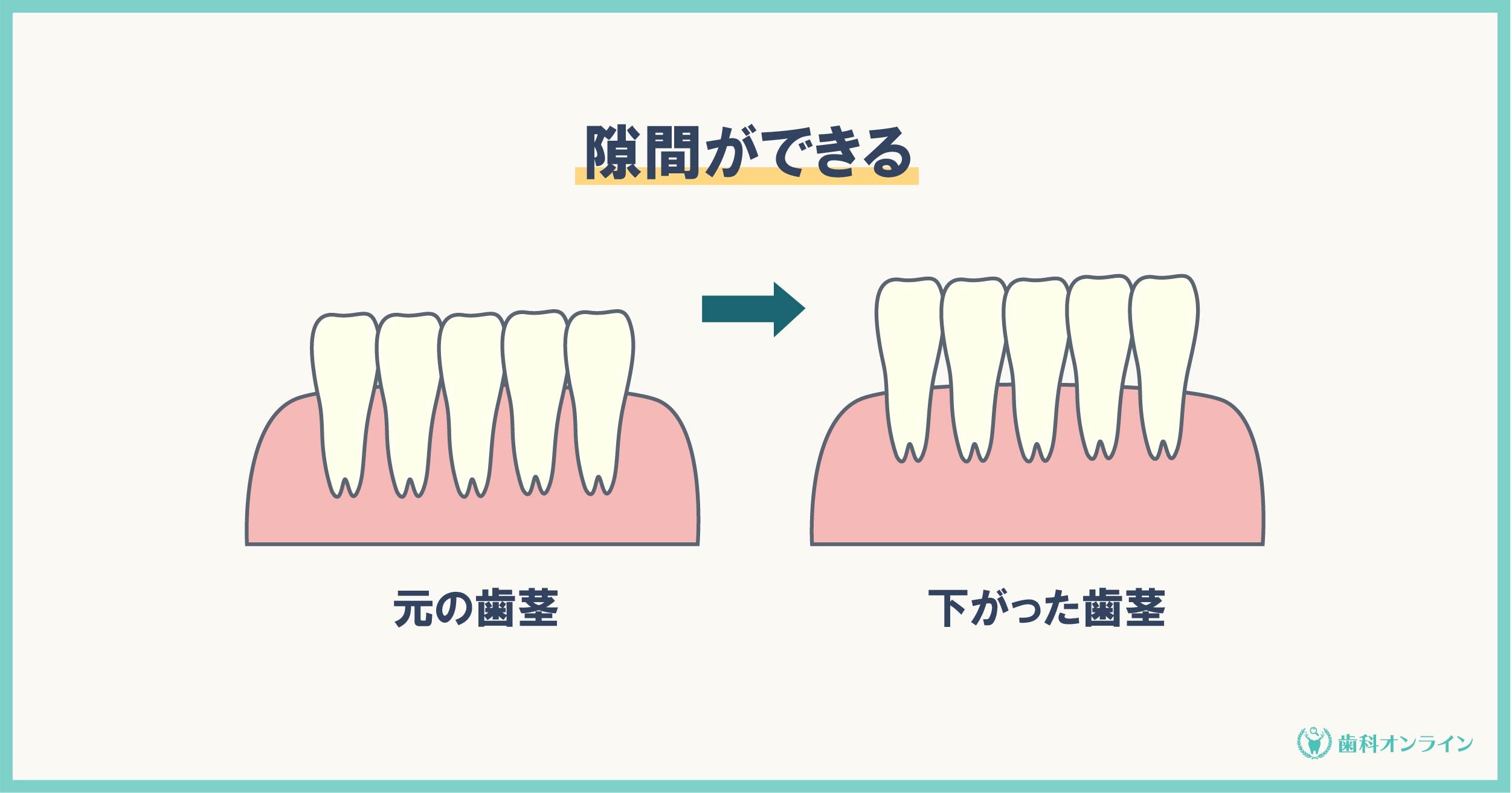 矯正でほうれい線が出現 大人の矯正で起こるトラブルやリスク 歯科オンライン